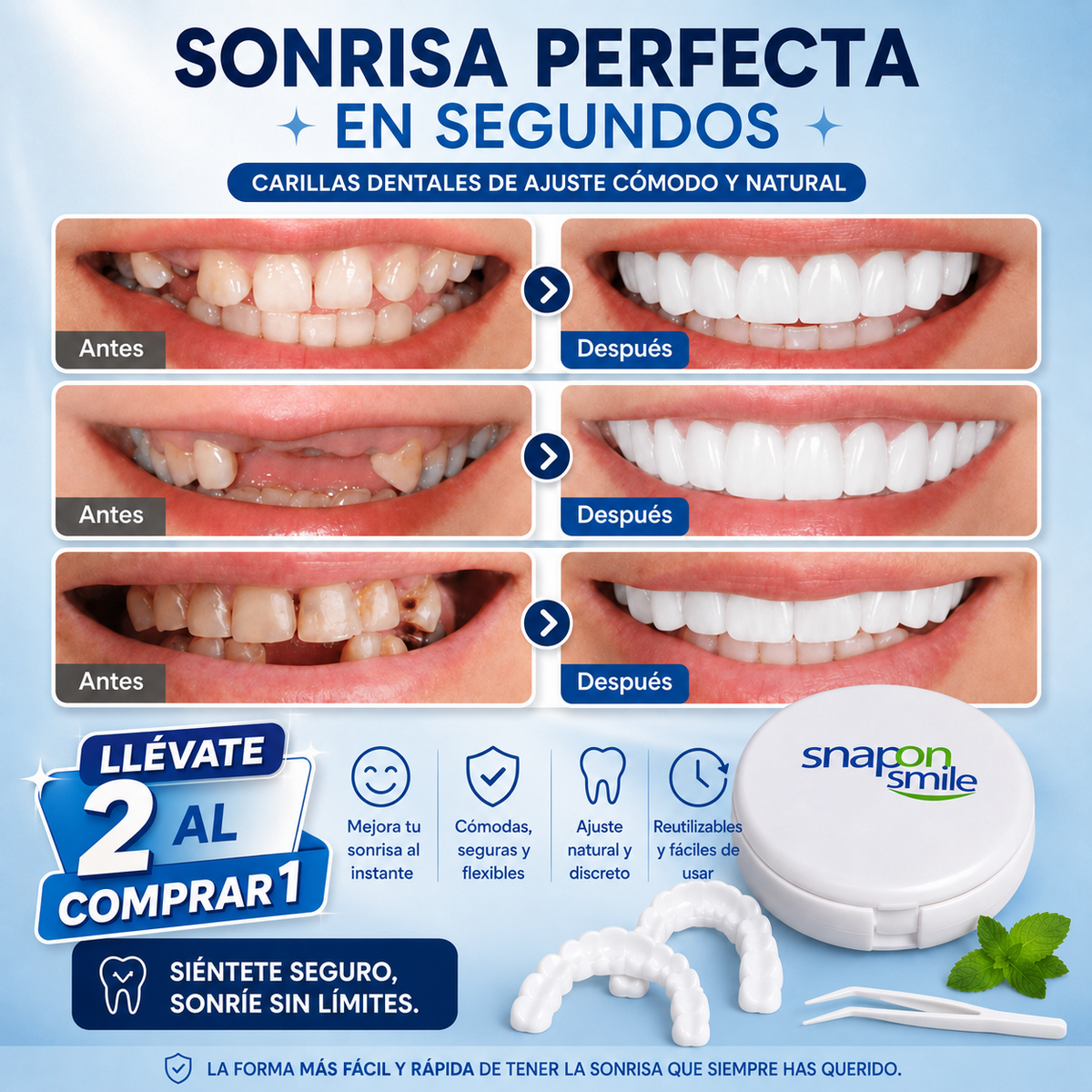 🦷 ¡Sonríe con confianza! Carillas Dentales Removibles
